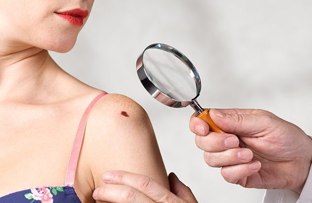 Antibiotic may kill dangerous skin cancer cells, says study