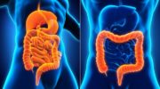 Facts about Crohn’s disease
